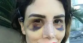 Após piora, empresário de Camilla Uckers pede ajuda no Instagram