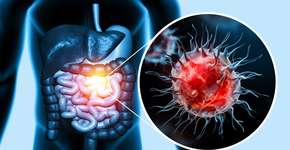 Foto: (iSTock/Mohammed Haneefa Nizamudeen)