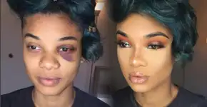 Mulher agredida emociona web ao explicar seu ‘antes e depois’