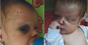 Mãe de 19 anos espanca bebê e o deixa sozinho para ir a encontro