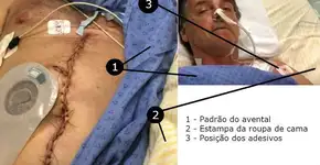 ‘Câncer’ de Bolsonaro em 1º lugar no campeonato de Fake News