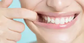 Foto: (Imagem sem texto alternativo disponivel ID [2463672])