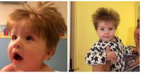 3 cortes em 5 meses de vida: conheça Stanley, o bebê cabeludo