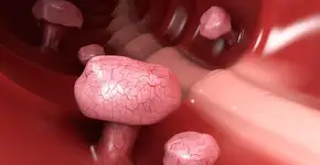 Foto: (tussik13/istock)