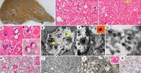 Foto: (Assessoria de Comunicação da FMUSP)
