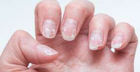 Foto: (iStock/Alena Ivochkina)