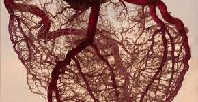 Evento no Villa Lobos orienta público sobre doenças vasculares