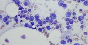 Foto: (OGphoto/istock)