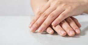 Foto: (Imagem sem texto alternativo disponivel ID [2697677])