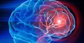 Estudo aponta que bebida popular pode aumentar o risco de derrame