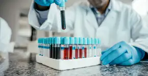 Foto: (Drs Producoes/istock)