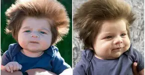 Conheça Cox, talvez o bebê mais cabeludo do mundo