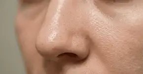 Foto: (Imagem sem texto alternativo disponivel ID [2751147])