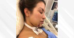 ‘Desesperador’, diz médica picada por jararaca em cachoeira no MT