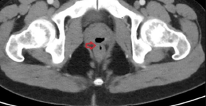 Foto: (Reprodução/Cureus Magazine)