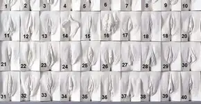 Foto: (Imagem sem texto alternativo disponivel ID [1163613])