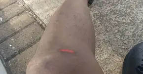 Professor é chamado de macaco e esfaqueado no Dia da Consciência Negra