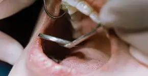 Como uma visita ao dentista pode ajudar a detectar doenças sistêmicas