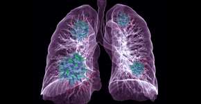 Foto: (mr.suphachai praserdumrongchai/iStock)