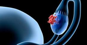 Foto: (Getty Images/iStockphoto)