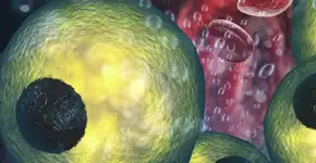 Esse é o motivo que você deve controlar o colesterol alto