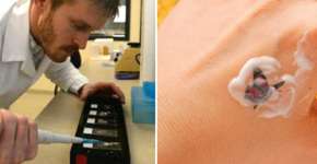 Canadense cria creme capaz de remover tatuagem sem dor