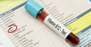 Foto: (blueshot/istock)