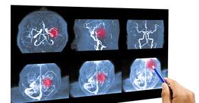 Foto: (iStock/Tonpor Kasa)