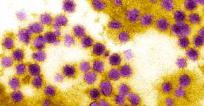 Foto: (imagepointfr/DepositPhotos)