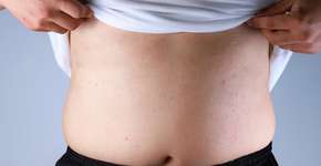 Chás poderosos para reduzir o inchaço após o fim de semana