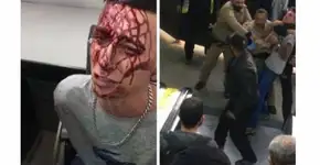 Ambulante acusa seguranças da CPTM de agressão; veja vídeo