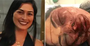 Mulher espancada e abandonada em estrada no ES tem alta médica