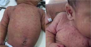 Foto: (reprodução/PG Invisível)