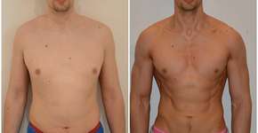 Com dieta radical, jovem perde 75% de sua gordura corporal em apenas 3 meses