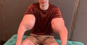 MMA: Vídeo mostra bíceps de lutador russo ‘explodindo’ após luta