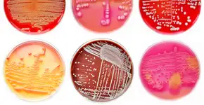 Foto: (jarun011/istock)