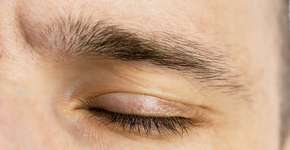 Foto: (iStock/Markovtel)