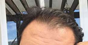 Foto: (Imagem sem texto alternativo disponivel ID [1428960])