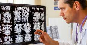 Estes alimentos podem reduzir o risco de demência, revela Queen’s University