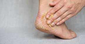 Lavar os pés com açúcar e limão: por que é recomendado e quando é melhor fazê-lo
