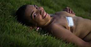 Câncer de mama: fotos mostram coragem e alegria de mulher após mastectomia