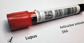 Foto: (iStock/Hailshadow)