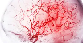 Foto: (mr.suphachai praserdumrongchai/istock)