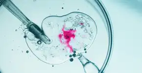 Foto: (Imagem sem texto alternativo disponivel ID [2674801])