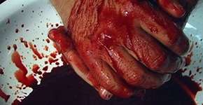 Foto: (Imagem sem texto alternativo disponivel ID [225825])