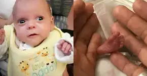 Ariana, que nasceu com 350g, recebe alta após 5 meses de hospital