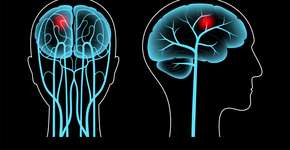 Foto: (Pikovit44/istock)