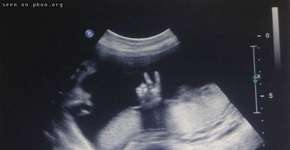 Engenheiros criam aparelho de ultrassom portátil e barato