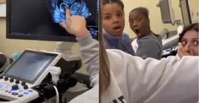 Reação de alunas “descobrindo” gravidez em aula de ultrassom viraliza