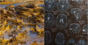 Foto: (PiLens/ IgorVetushko/DepositPhotos)